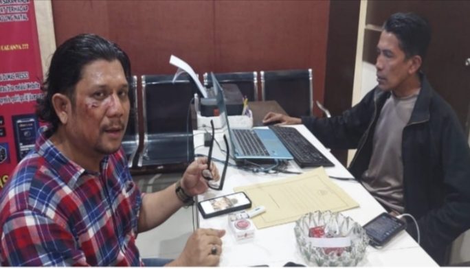 SMSI Pusat Desak Polisi Usut Kasus Penganiayaan Ketua SMSI Madina 1 IMG 20220305 154000