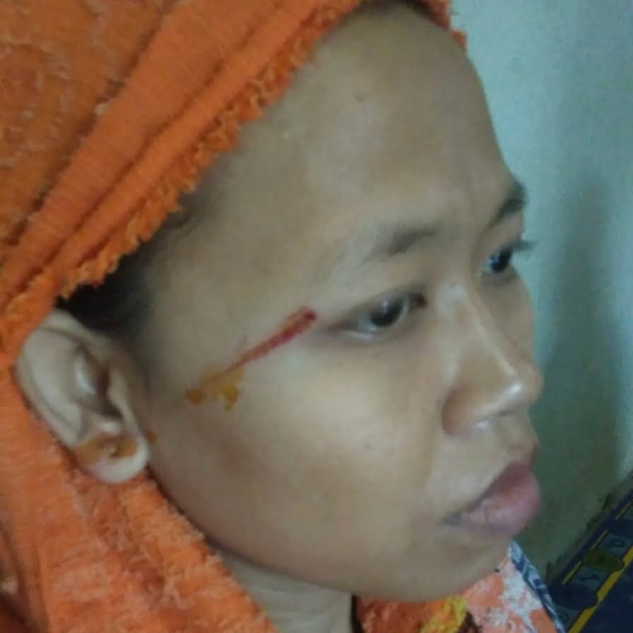 Duar! Rumah Warga Sidoharjo Dihajar Petir, Penghuni Luka di Pelipis 2 IMG 20220621 190539
